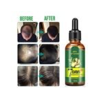 7 Days Hair Growth Oil - Image 4